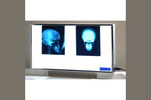 Velopex Super Viewer - универсальный негатоскоп для всех типов рентгенограмм